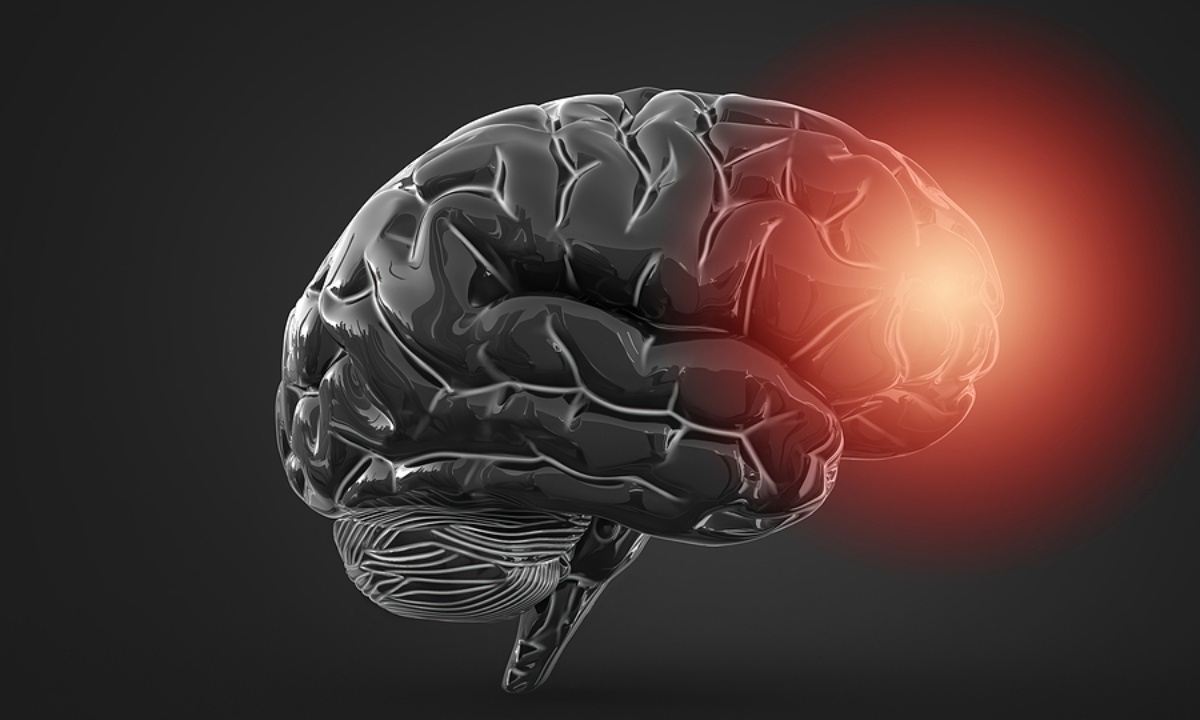 Εγκεφαλικό: Ποιοι ανήκουν στις ομάδες υψηλού κινδύνου (εικόνες)
