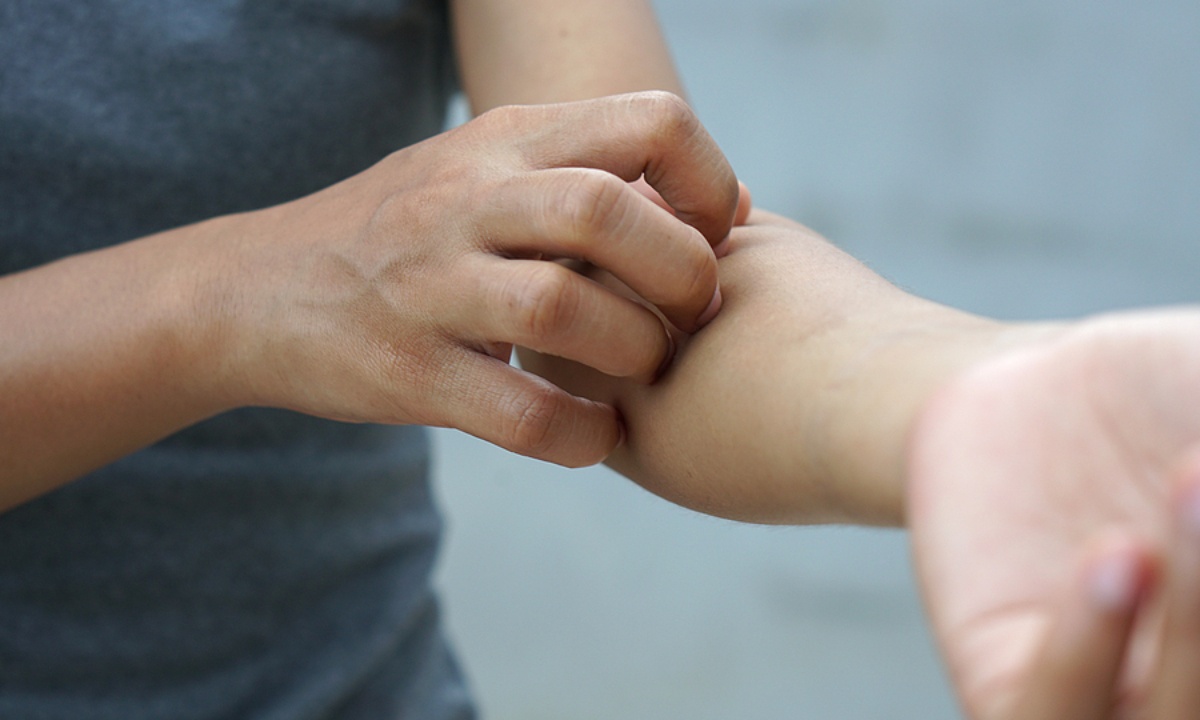 Σοβαρές παθήσεις που εκδηλώνονται με δερματικά συμπτώματα (εικόνες)