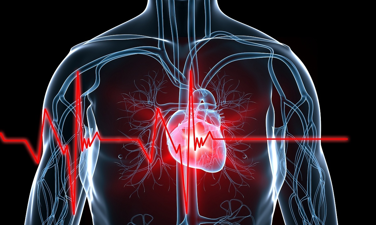 Οι παράδοξοι παράγοντες που πυροδοτούν τον κίνδυνο εμφράγματος (εικόνες)