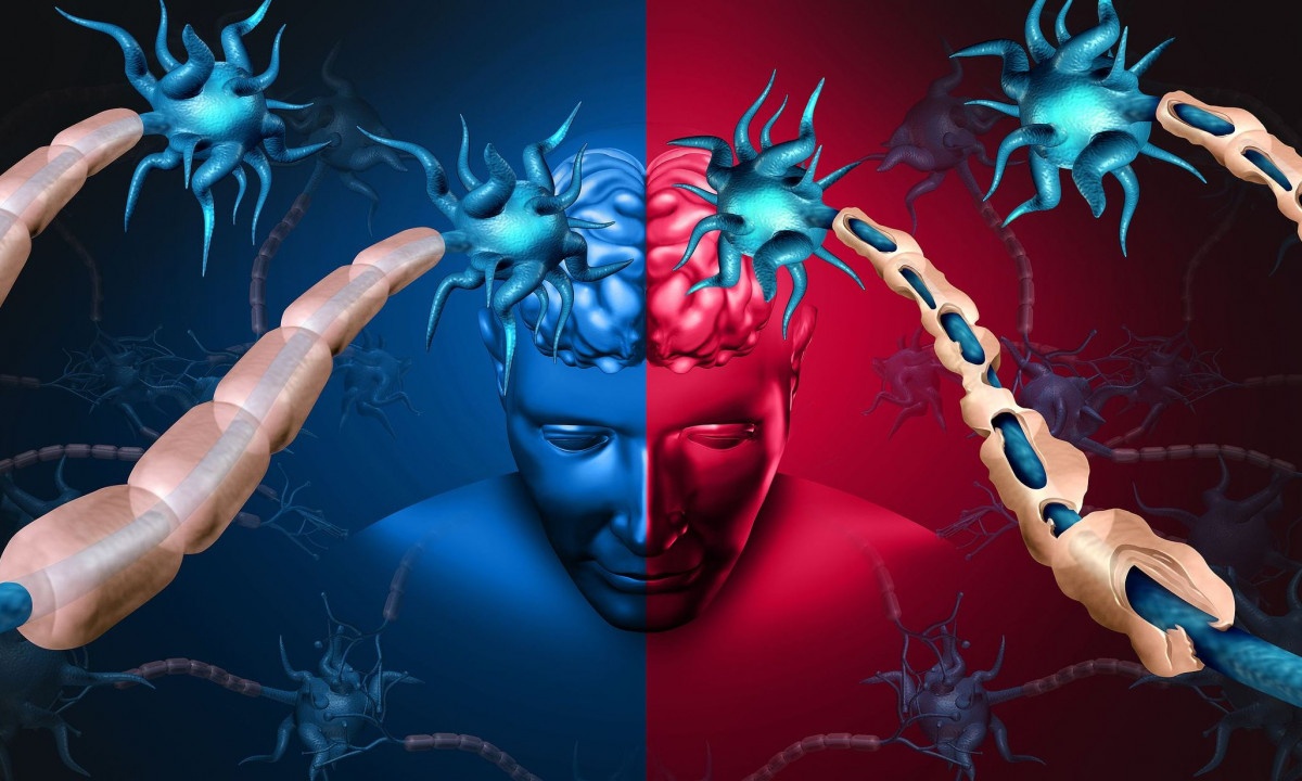 Πολλαπλή σκλήρυνση: Η τροφή που περιορίζει τη φλεγμονή και καθυστερεί τα συμπτώματα