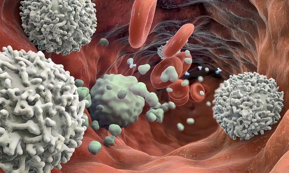 Οι καρκινικοί όγκοι μπορεί να περιέχουν πολλά είδη μυκήτων, σύμφωνα με νέα μελέτη