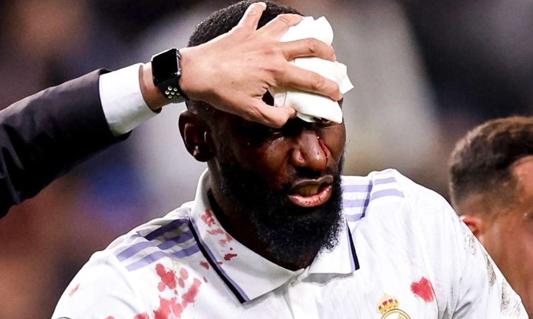 Μυθική ατάκα Ρούντιγκερ: «Αδερφέ έτσι κι αλλιώς άσχημος είμαι»! (Video)