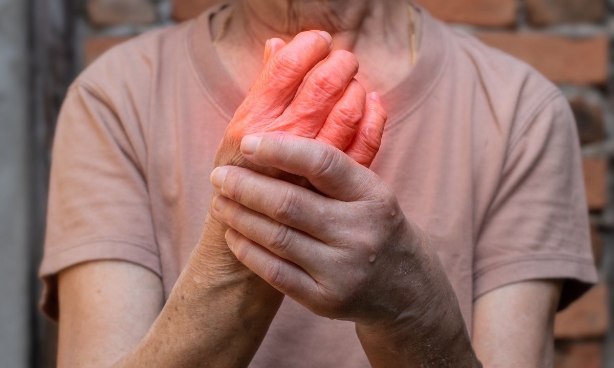 Ρευματοειδής αρθρίτιδα: Το φάρμακο που τη φρενάρει στο αρχικό στάδιο