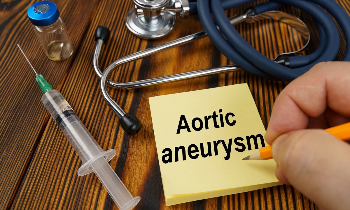 Ανεύρυσμα κοιλιακής αορτής: Τα φάρμακα που συμβάλλουν στην πρόληψη