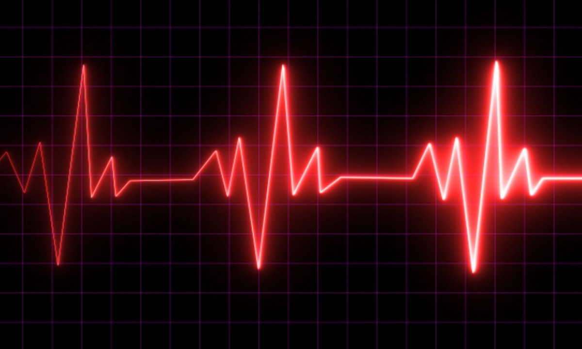 Αρρυθμίες: Ποια είναι τα συμπτώματα και πώς θα μειώσετε τον κίνδυνο