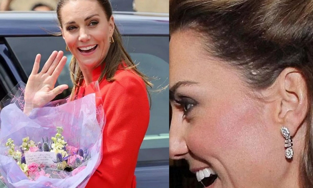 Κέιτ Μίντλετον: Η ουλή 6 εκατοστών στο κεφάλι & το κρίσιμο χειρουργείο