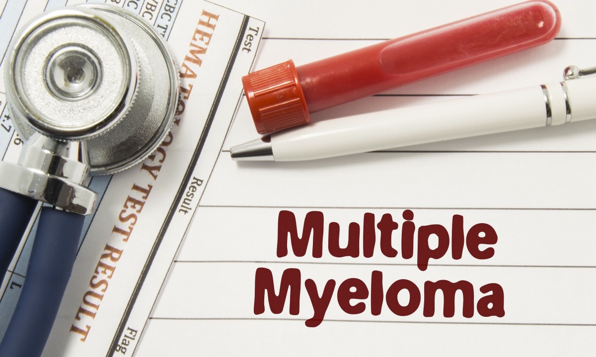 Πολλαπλό μυέλωμα: Ο ρόλος της παχυσαρκίας