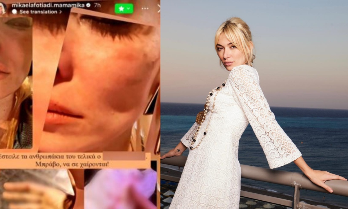 Θύμα ξυλοδαρμού το γνωστό μοντέλο Μικαέλα Φωτιάδη