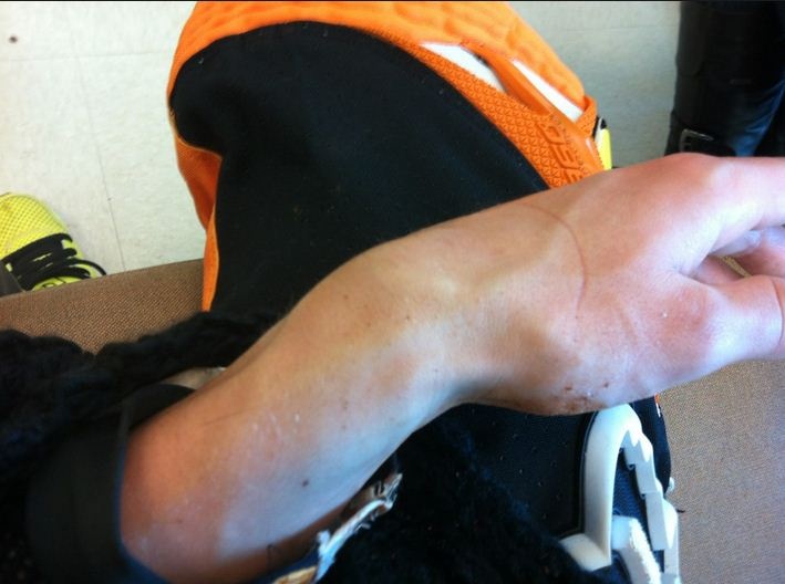 Τραυματίστηκε σε προπόνηση ο Ρόκζεν