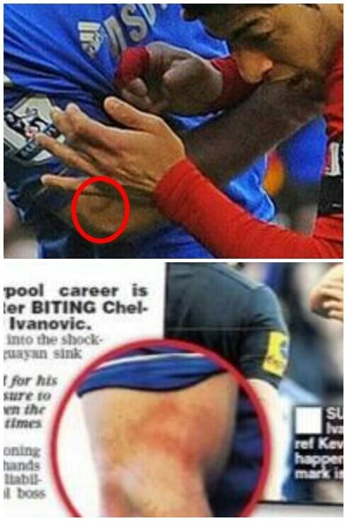 Τσέλσι: Το σημάδι του Σουάρεζ στον Ιβάνοβιτς (photo)