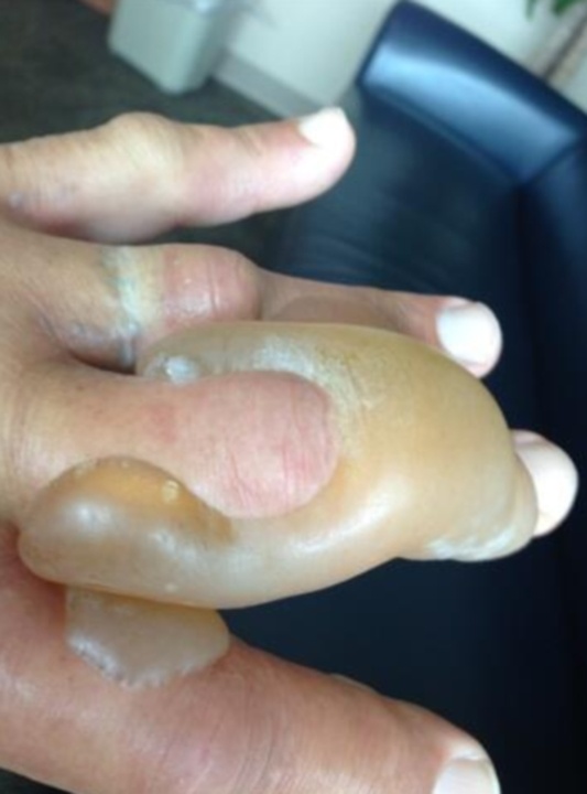 Ανατριχιαστικός τραυματισμός του Hulk Hogan (photos)