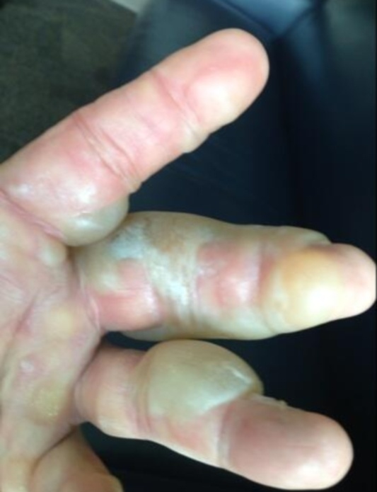 Ανατριχιαστικός τραυματισμός του Hulk Hogan (photos)