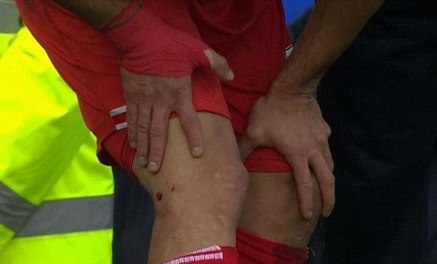 Έβερτον – Λίβερπουλ: Σαν τα… κοκόρια Μιραλάς και Σουάρεζ! (photos+video)