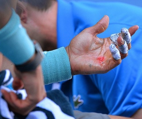Αυστραλιανό Όπεν: Το... αίμα του Ναδάλ (photos+video)