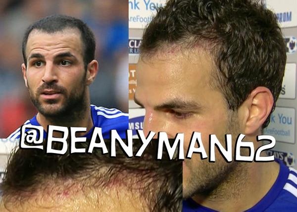 Τσέλσι: Έβαλε... μαλλιά ο Φάμπρεγκας! (photo)