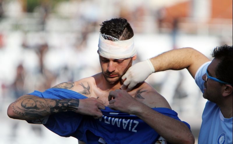 Πιερικός-Ηρακλής: Ο σοκαριστικός τραυματισμός του Ζιαμπάρη (photos+video)