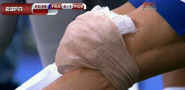 Κριστιάνο Ρονάλντο: Ο τραυματισμός με Γαλλία (photos+video)