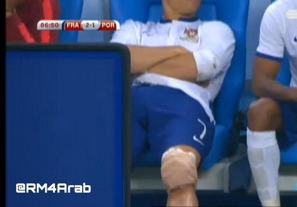 Κριστιάνο Ρονάλντο: Ο τραυματισμός με Γαλλία (photos+video)