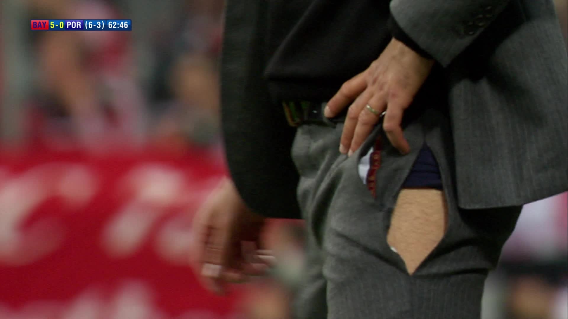 Μπάγερν Μονάχου: Ρεζίλι ο Γκουαρντιόλα με το σκισμένο παντελόνι! (photos)