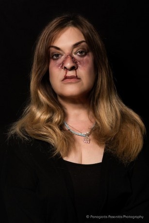 Ποιος «πλάκωσε» τη Νόνη Δούνια; (photos)