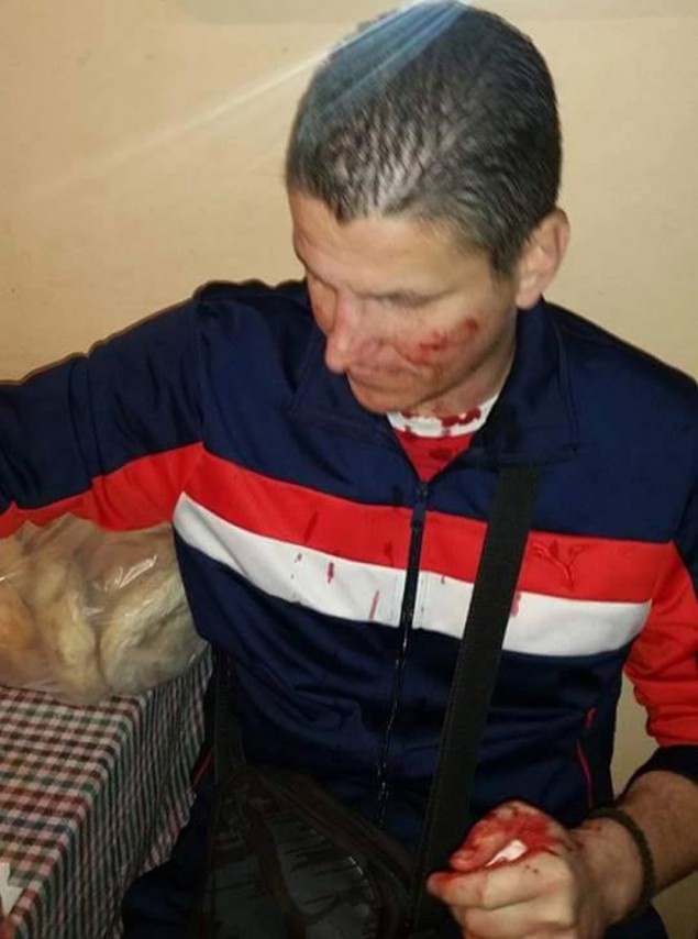 Εικόνες σοκ! Αλβανοί χούλιγκαν μαχαίρωσαν σε Σέρβους οπαδούς!