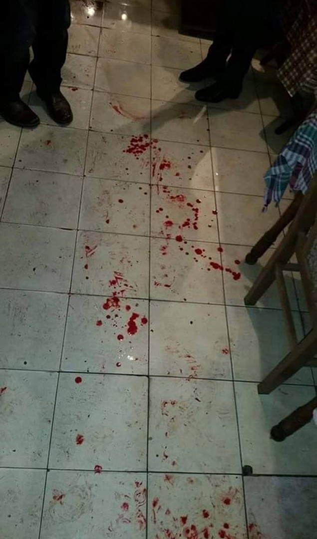 Εικόνες σοκ! Αλβανοί χούλιγκαν μαχαίρωσαν σε Σέρβους οπαδούς!