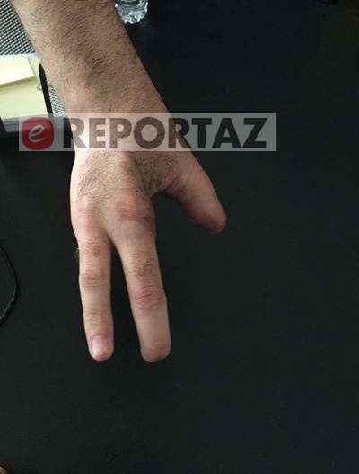 Σοκ με ακρωτηριασμένο φίλαθλο του Ολυμπιακού (photos)
