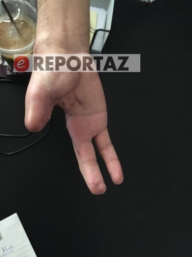 Σοκ με ακρωτηριασμένο φίλαθλο του Ολυμπιακού (photos)