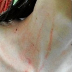 Γυναικείο ποδόσφαιρο: Οπαδοί εισέβαλαν στο γήπεδο και έδειραν τις παίκτριες! (photos)