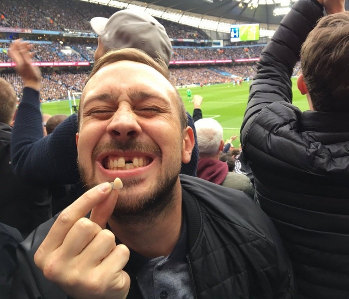 Του έφυγε το δόντι στους πανηγυρισμούς! (photo)