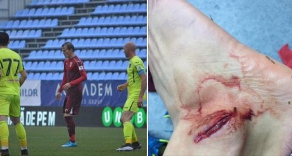 Σοκάρει ο σοβαρός τραυματισμός του Λαζάρ! (photo)