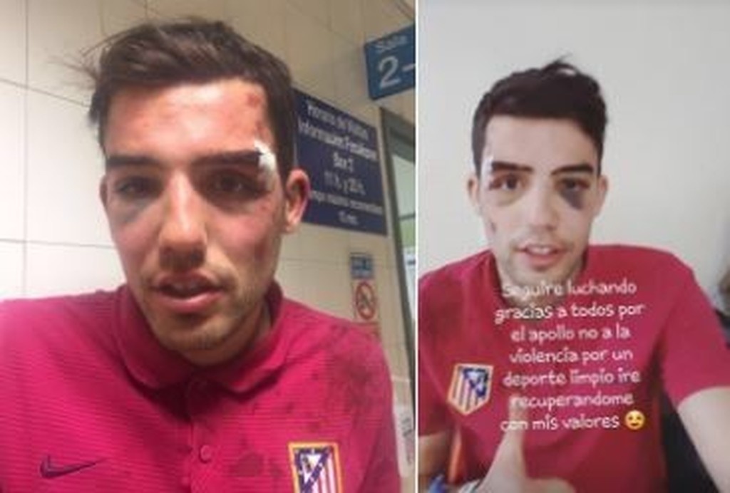 Οπαδοί της Ρεάλ «σάπισαν» στο ξύλο οπαδό της Ατλέτικο!