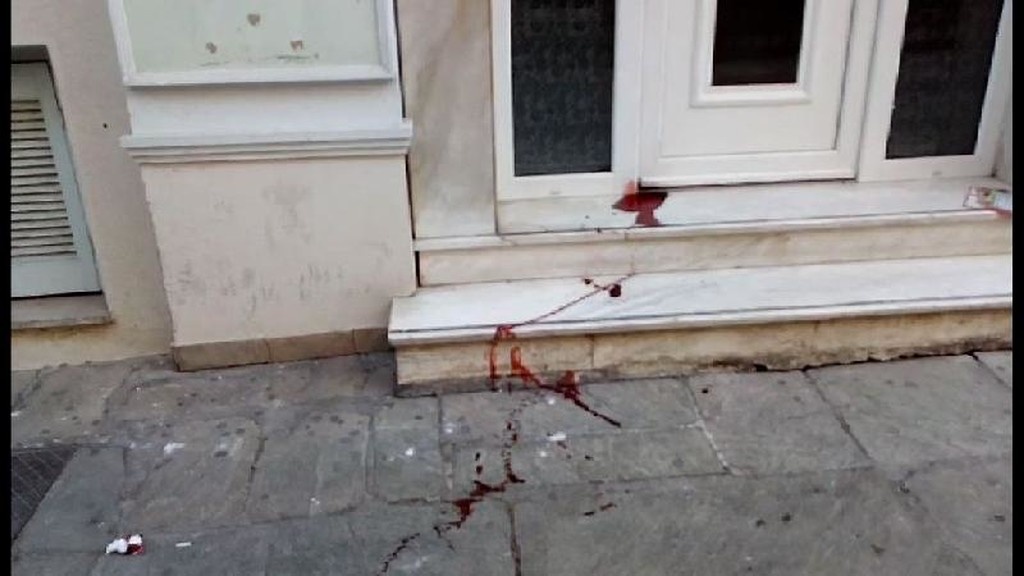 ΠΑΟΚ-ΑΕΚ: Αιματηρή συμπλοκή οπαδών στο Βόλο (σοκαριστικές εικόνες)