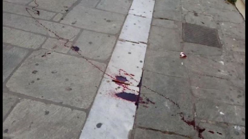 ΠΑΟΚ-ΑΕΚ: Αιματηρή συμπλοκή οπαδών στο Βόλο (σοκαριστικές εικόνες)