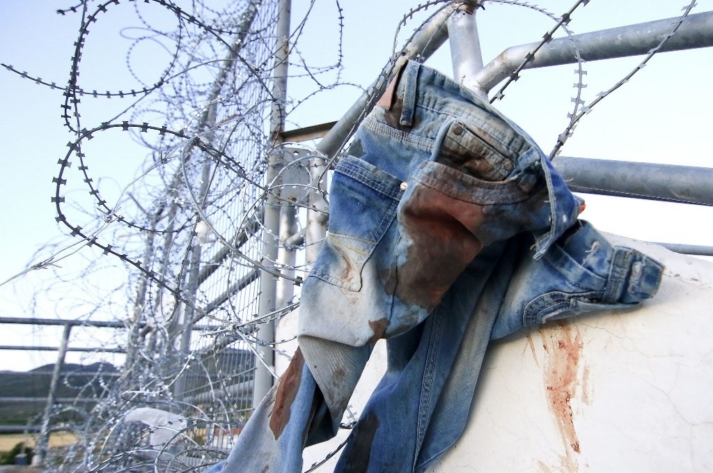 Τελικός Κυπέλλου: Σοκάρουν οι εικόνες με τα αίματα στο Πανθεσσαλικό!