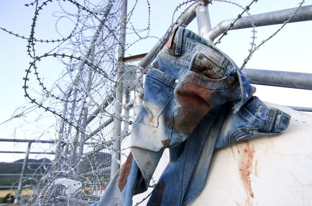 Τελικός Κυπέλλου: Σοκάρουν οι εικόνες με τα αίματα στο Πανθεσσαλικό!