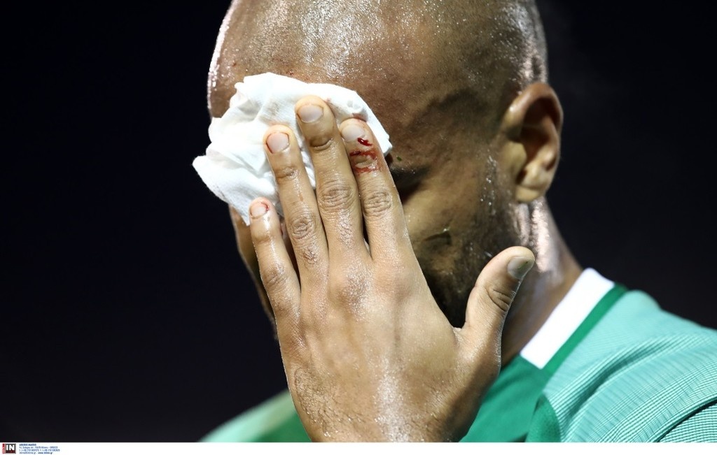 Παναθηναϊκός-ΑΕΚ: Το σοκ με Μολέδο που δεν πρόλαβε να χαρεί το γκολ (pics)