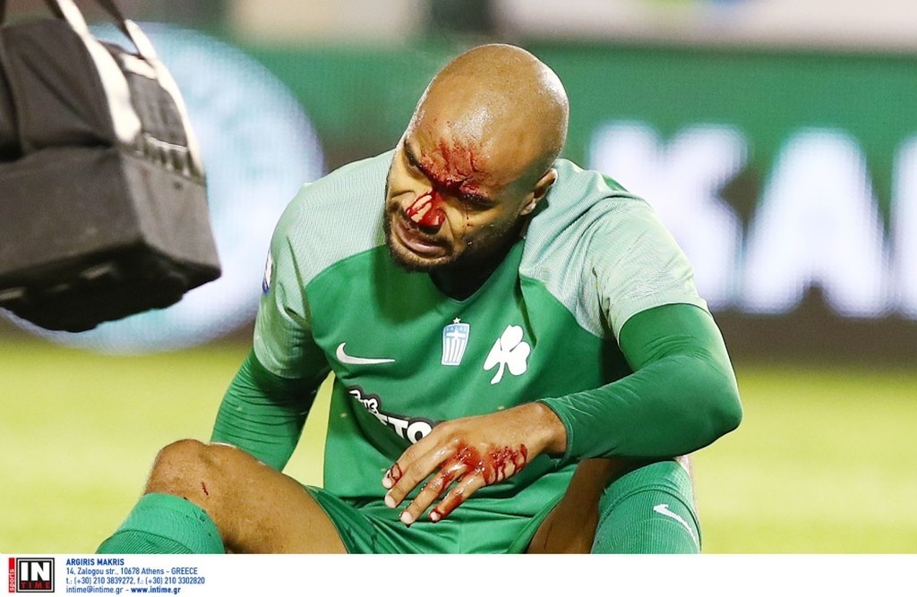 Παναθηναϊκός-ΑΕΚ: Το σοκ με Μολέδο που δεν πρόλαβε να χαρεί το γκολ (pics)