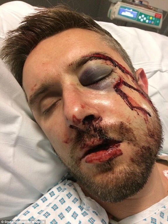 Απίστευτο: Χτύπησε σε αγώνα κι έγινε… ΕΤΣΙ! (photos)