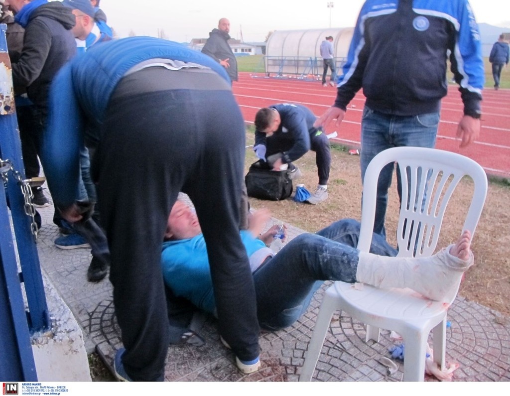 Χοντρό επεισόδιο και τραυματισμός οπαδού στο ΑΠΕ Λαγκαδάς-Ηρακλής (photos)