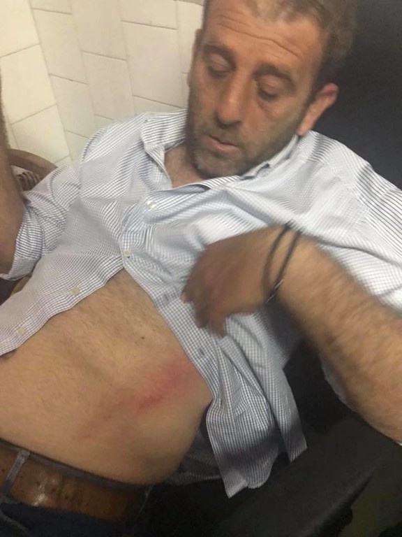 Γ' Εθνική: Επεισόδια στην Αμαλιάδα, έπεσε ξύλο στο ημίχρονο - Τραυματίστηκαν παίκτες (photos)