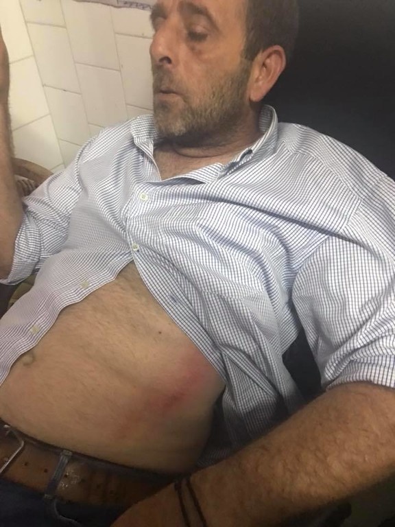 Γ' Εθνική: Επεισόδια στην Αμαλιάδα, έπεσε ξύλο στο ημίχρονο - Τραυματίστηκαν παίκτες (photos)