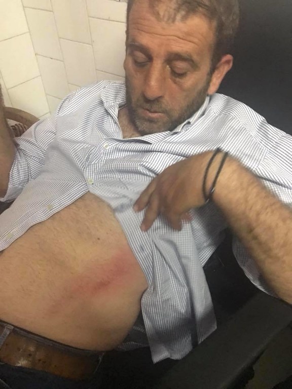 Γ' Εθνική: Επεισόδια στην Αμαλιάδα, έπεσε ξύλο στο ημίχρονο - Τραυματίστηκαν παίκτες (photos)