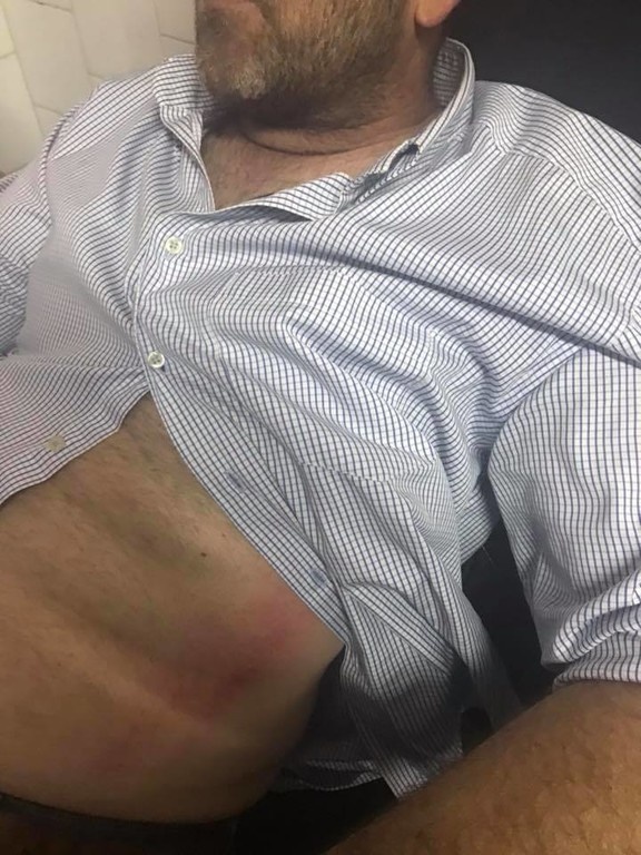 Γ' Εθνική: Επεισόδια στην Αμαλιάδα, έπεσε ξύλο στο ημίχρονο - Τραυματίστηκαν παίκτες (photos)