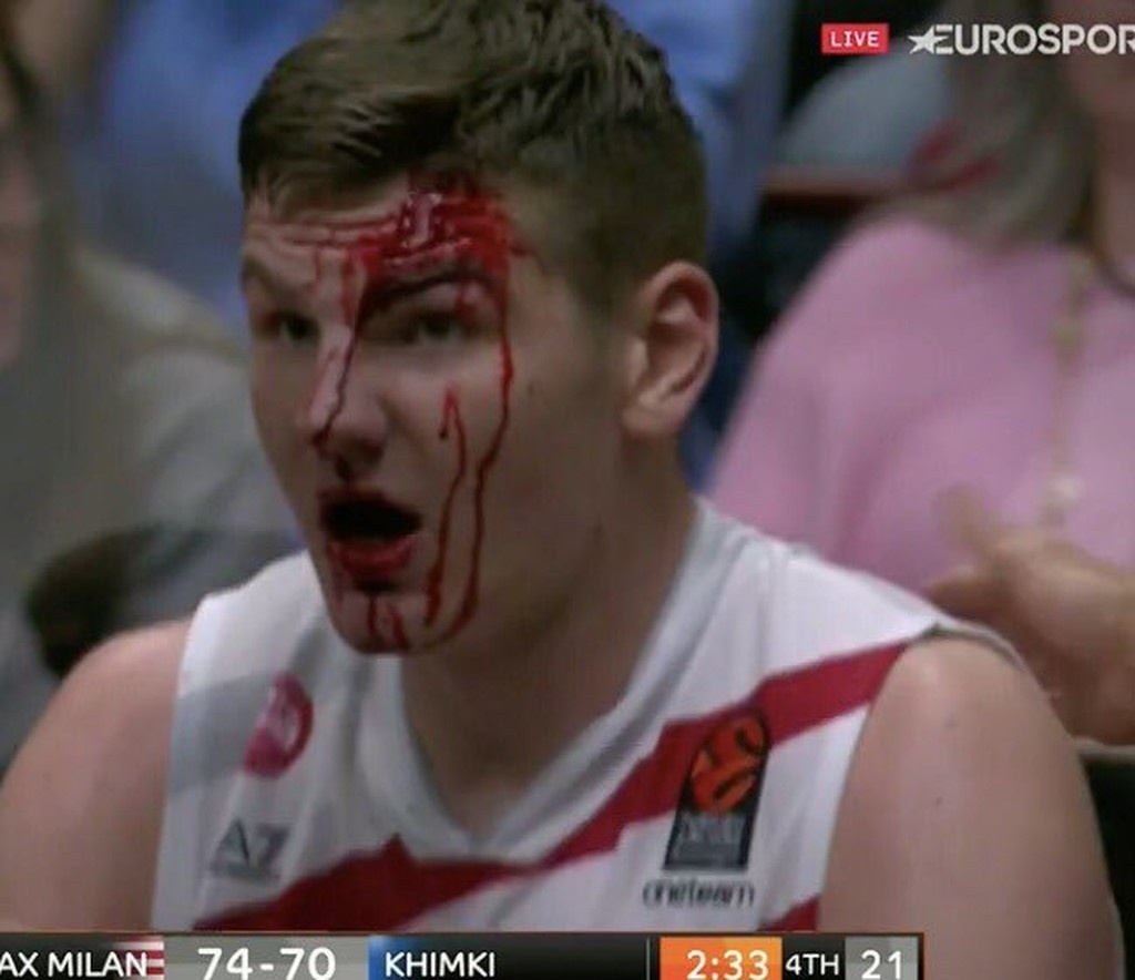 Σοκάρει η φωτογραφία του ματωμένου Γκουντάιτις (photo)