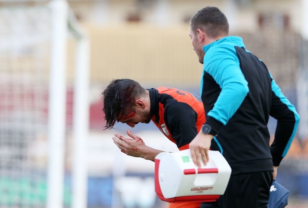 Σοκαριστικός τραυματισμός του Κάστρο! (photos)