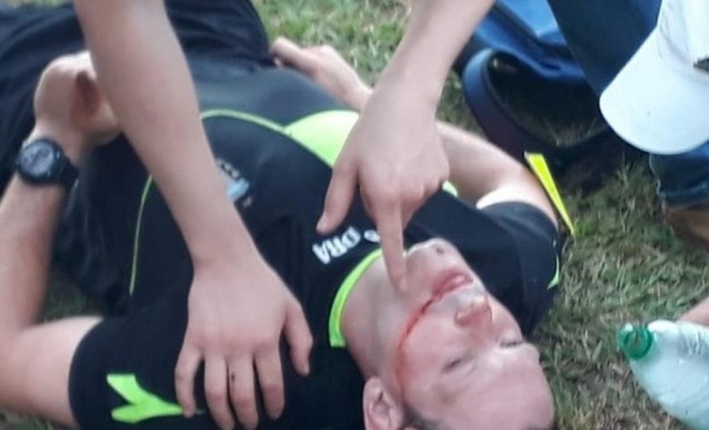 Απίστευτο: Έσπασε στο ξύλο διαιτητή εν ώρα αγώνα! (vids)