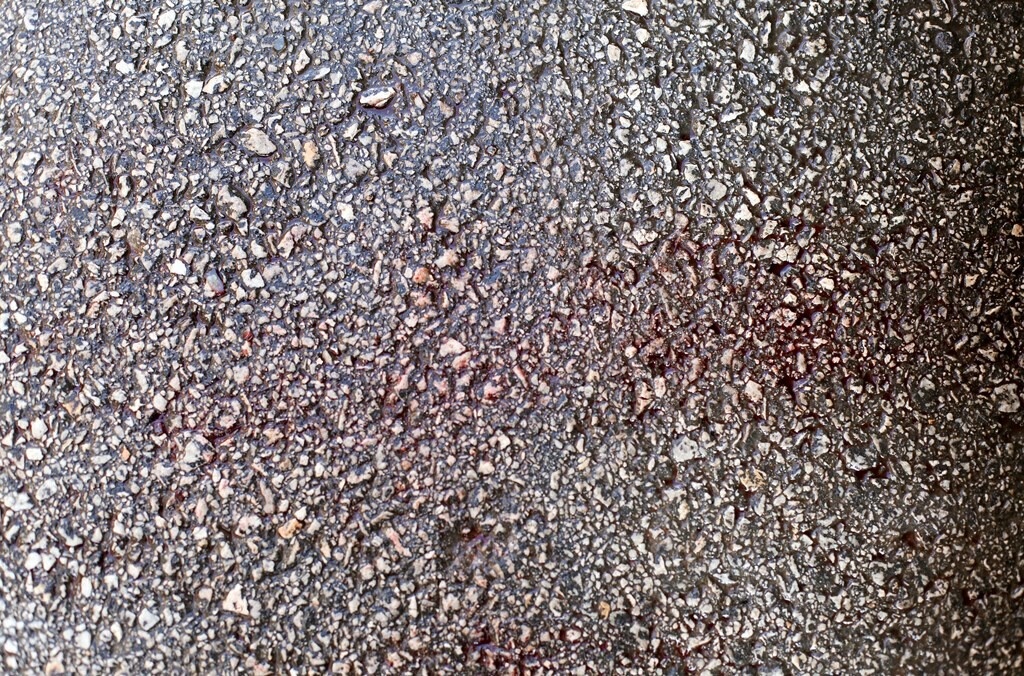 Ξυλοδαρμός Τζήλου: Αυτή είναι η έκθεση της ΕΛΑΣ (photos)