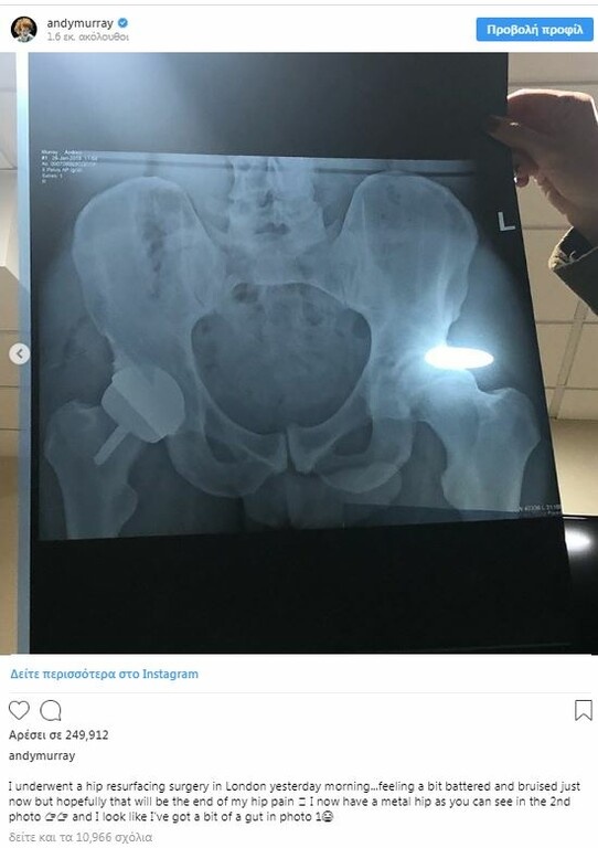 Επέμβαση στο ισχίο για Μάρεϊ (photoς)