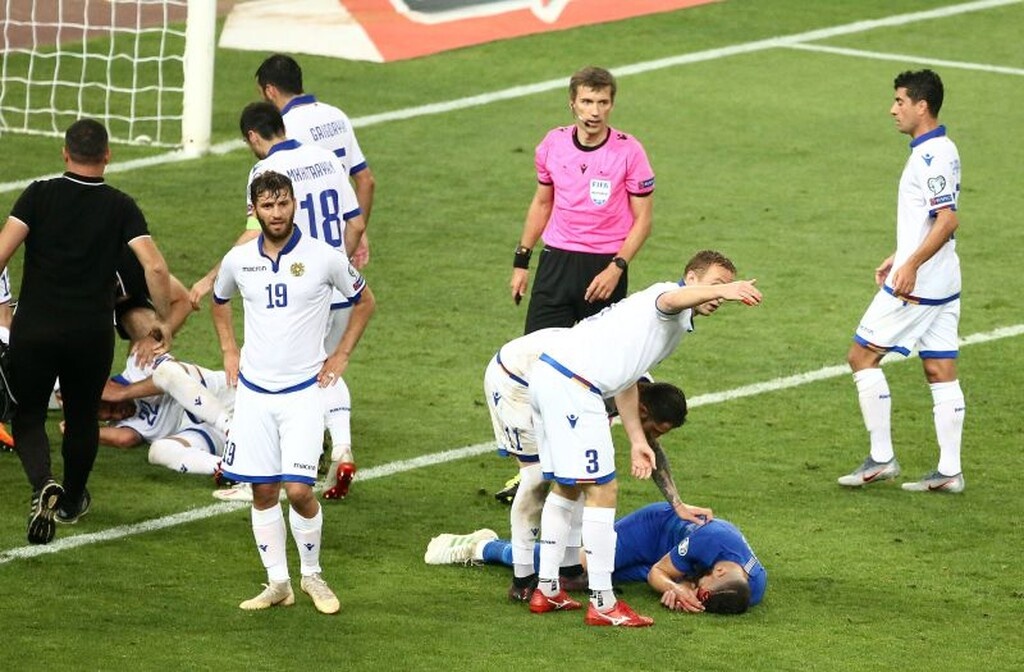 Ελλάδα – Αρμενία: Σφοδρή σύγκρουση και… ματωμένο κεφάλι για Σιόβα (photos+videos)